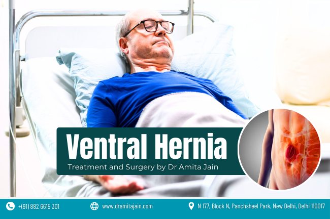  best Ventral Hernia surgeon in Delhi
